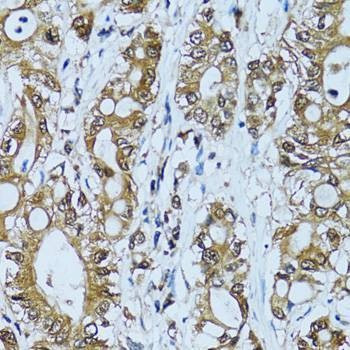 Anti-NOL3 Antibody