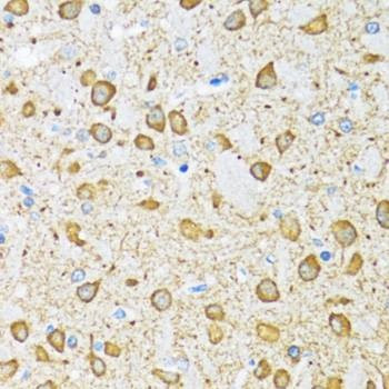 Anti-NOL3 Antibody