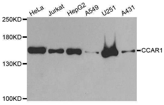 Anti-CCAR1 Antibody