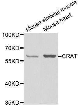 Anti-CRAT Antibody