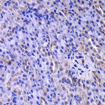 Anti-DTYMK Antibody