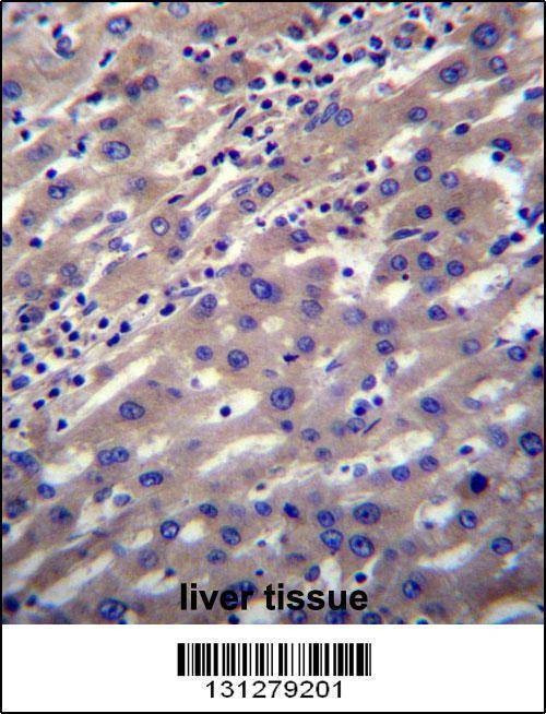 Anti-SCP2 (N-term) Antibody
