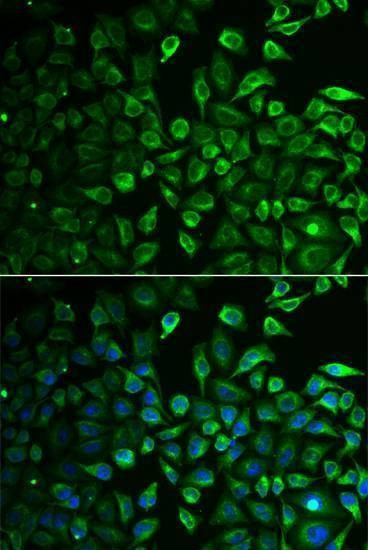 Anti-IMPA1 Antibody