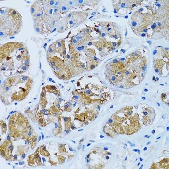 Anti-IMPA1 Antibody