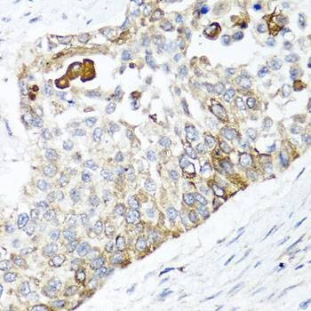 Anti-PPOX Antibody
