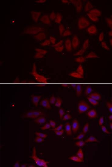 Anti-RPL11 Antibody