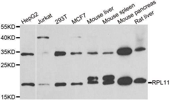 Anti-RPL11 Antibody