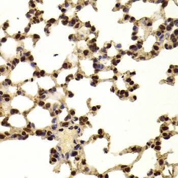 Anti-AAAS Antibody