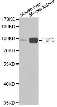 Anti-H6PD Antibody