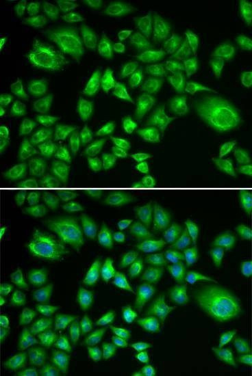 Anti-H6PD Antibody