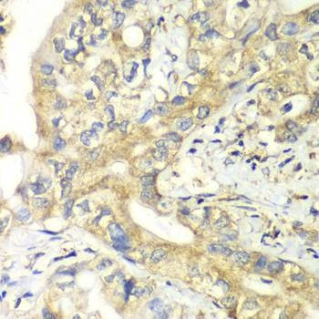 Anti-TIMM17A Antibody