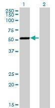 Anti-CAMK1G Antibody