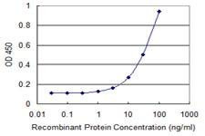 Anti-CAMK1G Antibody