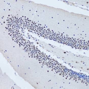 Anti-AHSP Antibody