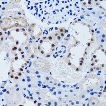 Anti-AHSP Antibody