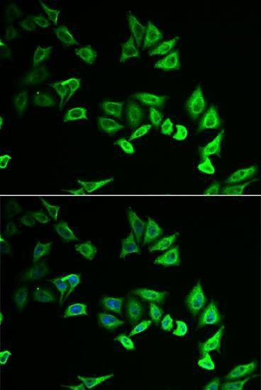 Anti-MYOZ2 Antibody