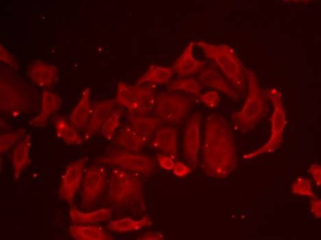 Anti-TRPV5 Antibody