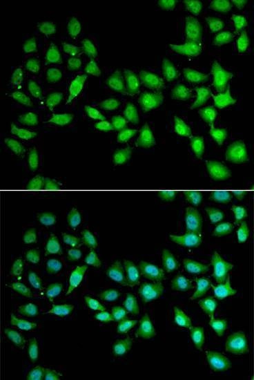 Anti-UCN2 Antibody