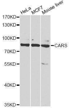 Anti-CARS Antibody