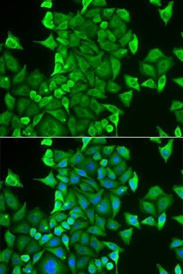 Anti-CARS Antibody