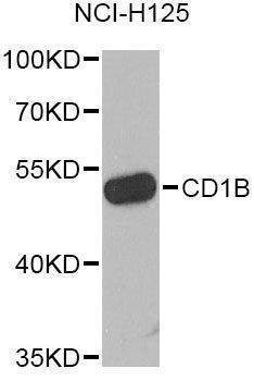 Anti-CD1B Antibody