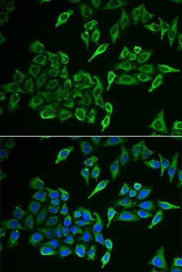 Anti-COX4I1 Antibody