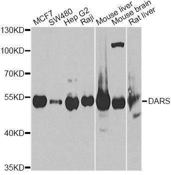Anti-DARS Antibody