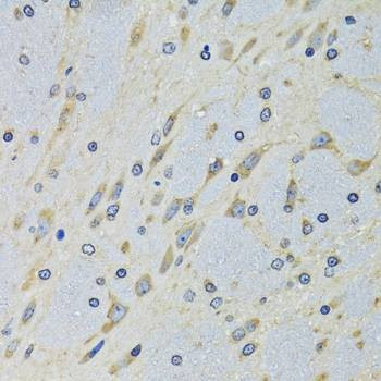Anti-DARS Antibody