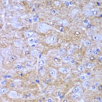 Anti-DDX1 Antibody