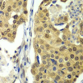 Anti-DDX1 Antibody