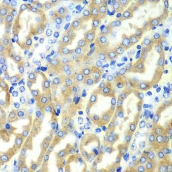 Anti-DDX1 Antibody