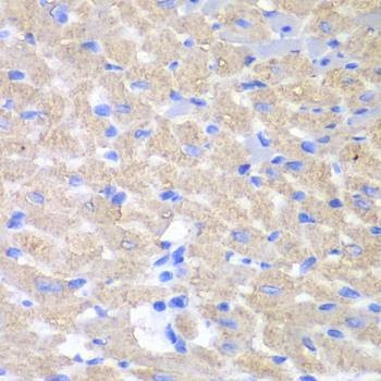 Anti-GPAM Antibody