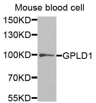 Anti-GPLD1 Antibody