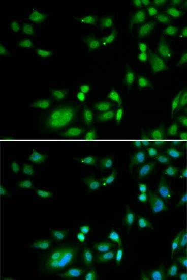 Anti-INTS10 Antibody