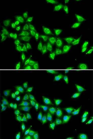 Anti-KIF3A Antibody