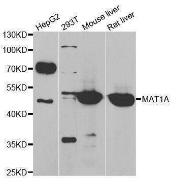 Anti-MAT1A Antibody