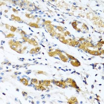 Anti-OGN Antibody