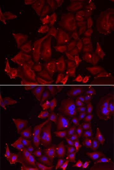 Anti-PANX1 Antibody