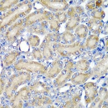 Anti-PDCD6 Antibody