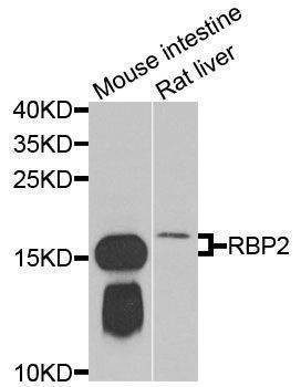 Anti-RBP2 Antibody