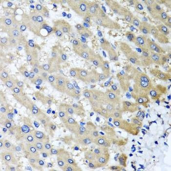 Anti-RBP2 Antibody