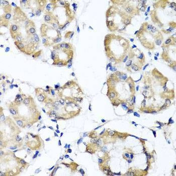 Anti-RBP2 Antibody