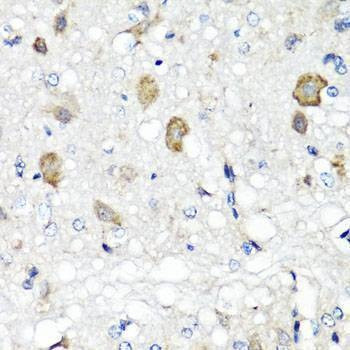 Anti-RBP2 Antibody