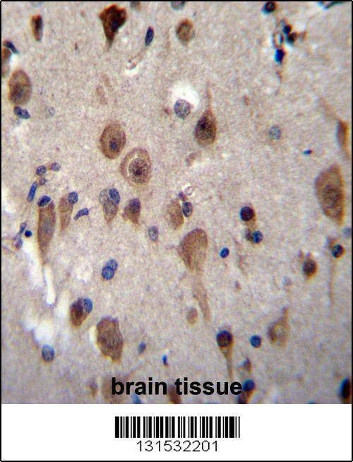 Anti-LRRC28 (C-term) Antibody