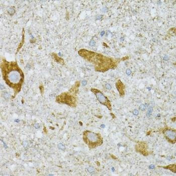 Anti-ST3GAL3 Antibody