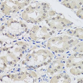 Anti-AGO2 Antibody