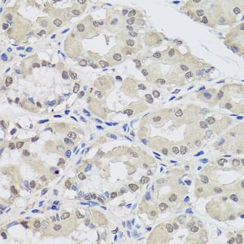 Anti-AGO2 Antibody
