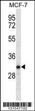 Anti-TESSP1 (Center) Antibody