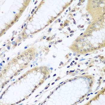 Anti-WDR48 Antibody