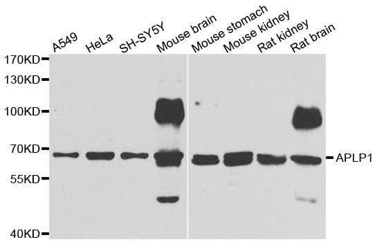 Anti-APLP1 Antibody